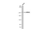 LRRK2 Antibody in Western Blot (WB)
