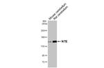 NTE Antibody in Western Blot (WB)