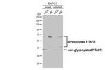 PTAFR Recombinant Rabbit Monoclonal Antibody (HL2998)