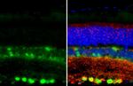 PGP9.5 Antibody in Immunohistochemistry (Paraffin) (IHC (P))
