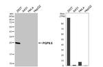PGP9.5 Antibody in Western Blot (WB)