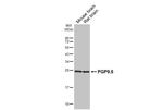 PGP9.5 Antibody in Western Blot (WB)