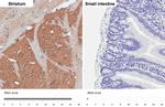 PHACTR1 Antibody in Immunohistochemistry (Paraffin) (IHC (P))
