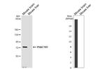 PHACTR1 Antibody in Western Blot (WB)