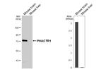 PHACTR1 Antibody in Western Blot (WB)