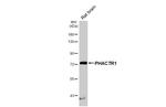 PHACTR1 Antibody in Western Blot (WB)