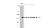 Phospho-PLCG2 (Tyr1217) Recombinant Rabbit Monoclonal Antibody (HL3406)