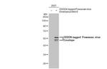 Powassan Virus Envelope (Strain#LB) Antibody in Western Blot (WB)