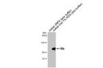 Rb Antibody in Western Blot (WB)