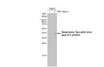 Respiratory Syncytial Virus Type A (G glycoprotein) (strain A2) Antibody in Western Blot (WB)