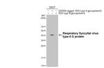 Respiratory Syncytial Virus Type A (G glycoprotein) (strain A2) Recombinant Rabbit Monoclonal Antibody (HL2643)
