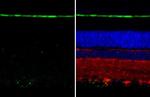 RGR Antibody in Immunohistochemistry (Paraffin) (IHC (P))