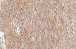 SMO Recombinant Rabbit Monoclonal Antibody (HL3055)