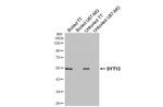 SYT13 Recombinant Rabbit Monoclonal Antibody (HL3579)