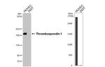 Thrombospondin 1 Recombinant Rabbit Monoclonal Antibody (HL3593)
