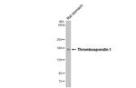 Thrombospondin 1 Antibody in Western Blot (WB)