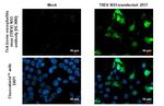 Tick-Borne Encephalitis Virus NS5 Recombinant Rabbit Monoclonal Antibody (HL3880)