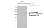 Tick-Borne Encephalitis Virus NS5 Antibody in Western Blot (WB)