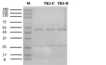 TK1 protein Recombinant Mouse Monoclonal Antibody (10C2)