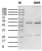 Sinomenine Antibody in SDS-PAGE (SDS-PAGE)