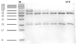 Simvastatin Antibody in SDS-PAGE (SDS-PAGE)