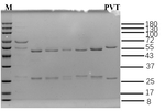 Pravastatin Antibody in SDS-PAGE (SDS-PAGE)