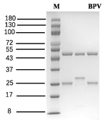 Bupivacaine Recombinant Mouse Monoclonal Antibody (2C8)