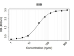 SSB Recombinant Human Monoclonal Antibody (K70030_11G5)