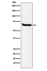 Klotho Antibody in Western Blot (WB)