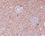 APAF1 Recombinant Rabbit Monoclonal Antibody (K01_3M90)