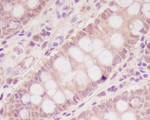 IGF2R Recombinant Rabbit Monoclonal Antibody (K01_3M91)