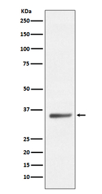 SIRT5 Recombinant Rabbit Monoclonal Antibody (K01_3M96)