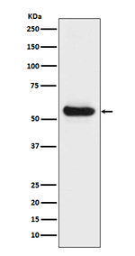 LPL Antibody in Western Blot (WB)