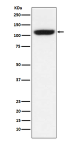 TRPM8 Antibody in Western Blot (WB)