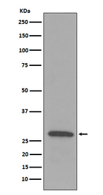 C1QB Recombinant Rabbit Monoclonal Antibody (K01_3N10)