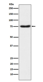 NTN1 Recombinant Rabbit Monoclonal Antibody (K01_3N12)
