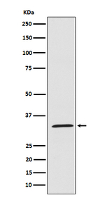 UCP1/UCP3 Recombinant Rabbit Monoclonal Antibody (K01_3N13)