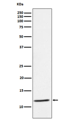 TYROBP Recombinant Rabbit Monoclonal Antibody (K01_3N16)