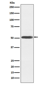 INHBB Recombinant Rabbit Monoclonal Antibody (K01_3N22)
