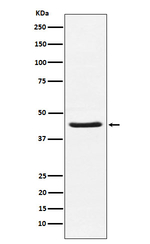 HSD3B1 Recombinant Rabbit Monoclonal Antibody (K01_3N28)