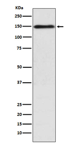 COL11A1 Recombinant Rabbit Monoclonal Antibody (K01_3N30)