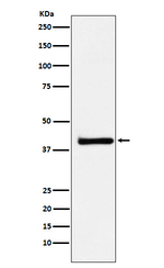 XRCC3 Recombinant Rabbit Monoclonal Antibody (K01_3N32)