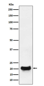 DCTN5 Recombinant Rabbit Monoclonal Antibody (K01_3N33)