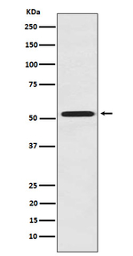 FMO3 Recombinant Rabbit Monoclonal Antibody (K01_3N34)