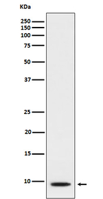 CXCL5 Recombinant Rabbit Monoclonal Antibody (K01_3N40)