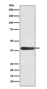 Fra1 Recombinant Rabbit Monoclonal Antibody (K01_3N45)