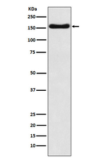 ATP7B Recombinant Rabbit Monoclonal Antibody (K01_3N46)