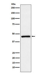 TMEFF2 Recombinant Rabbit Monoclonal Antibody (K01_3N47)