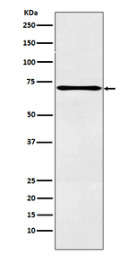 ALOX12 Recombinant Rabbit Monoclonal Antibody (K01_3N48)