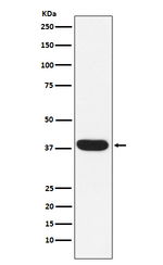 MYF5 Recombinant Rabbit Monoclonal Antibody (K01_3N50)